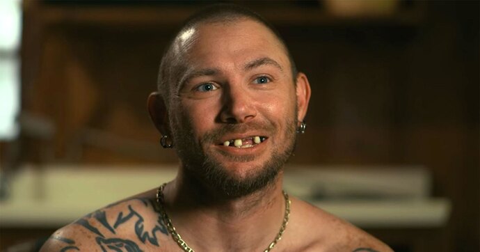 John-Finlay-before-and-after-new-teeth-Tiger-King-2